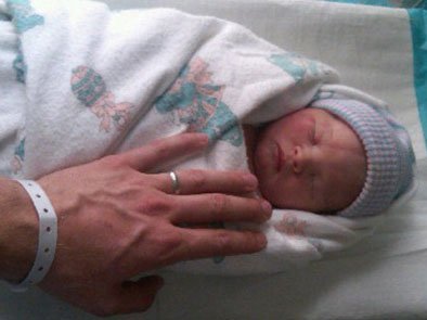 Baş neanotoloq: Azərbaycanda körpələrin 10 faizi vaxtından əvvəl doğulur