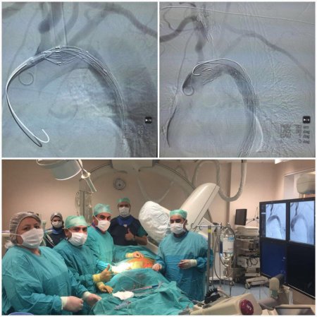 Azərbaycanda ürəyin müalicəsi üçün yeni metod tətbiq edildi 