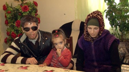 Azərbaycanlı gənc gözlərini sevgisinə qurban verdi: "Yuxuda görə bilirəm"